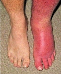cellulitis sf studios london