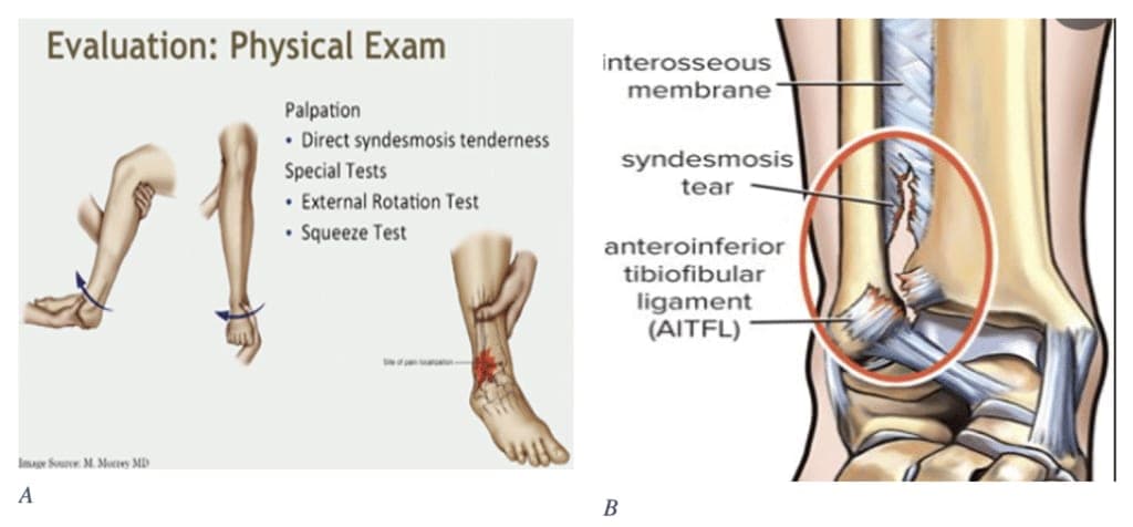 evaluation of ankle and foot sf studios london
