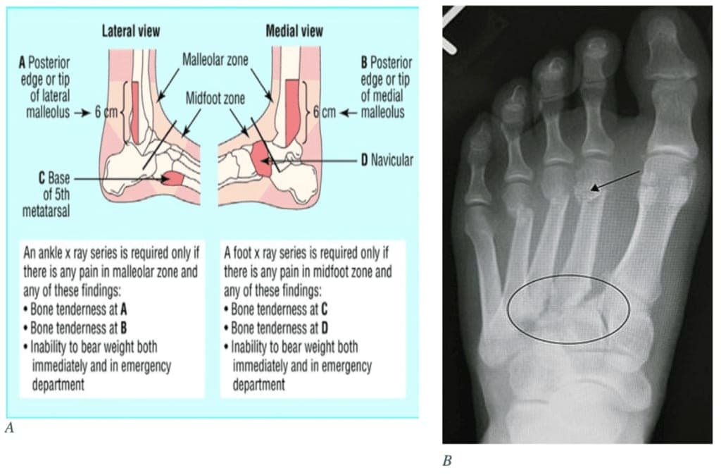 foot and ankle xray sf studios london