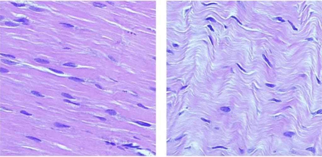 healthy vs damaged tendon under microscope sf studios london